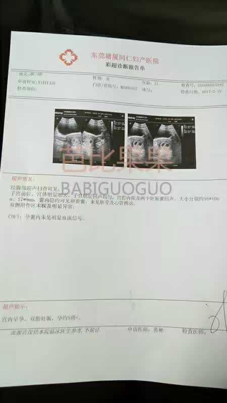 L美女的B超报告已经确定着床了双胞胎