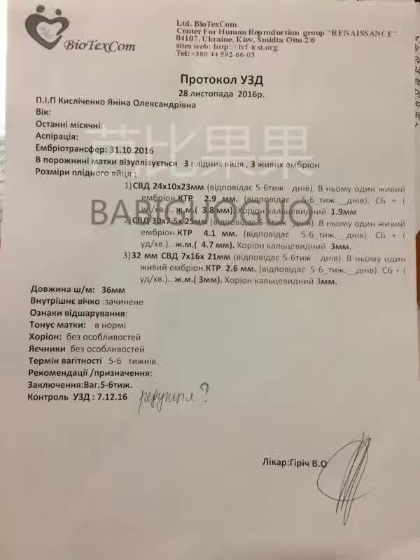 SGM移植成功后B超检查 宫内着床了三胞胎